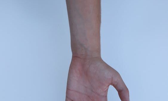 Thin content: cos'è e come risolvere il problema dei contenuti scarsi