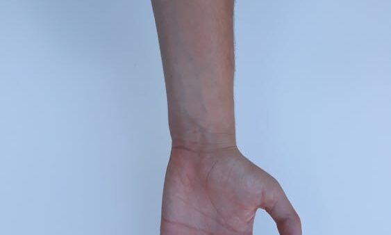 SEO per dentisti: strategie per dominare le ricerche locali