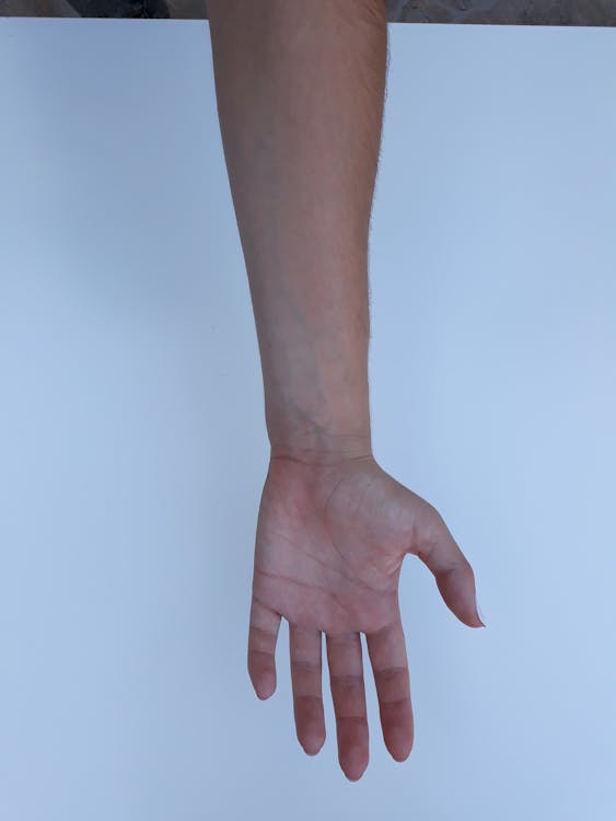 SEO per dentisti: strategie per dominare le ricerche locali